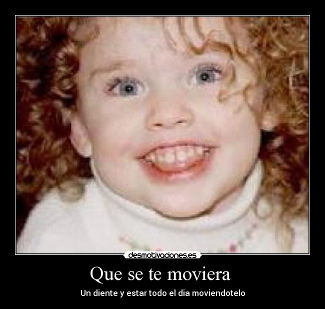 Que se te moviera  - Un diente y estar todo el dia moviendotelo