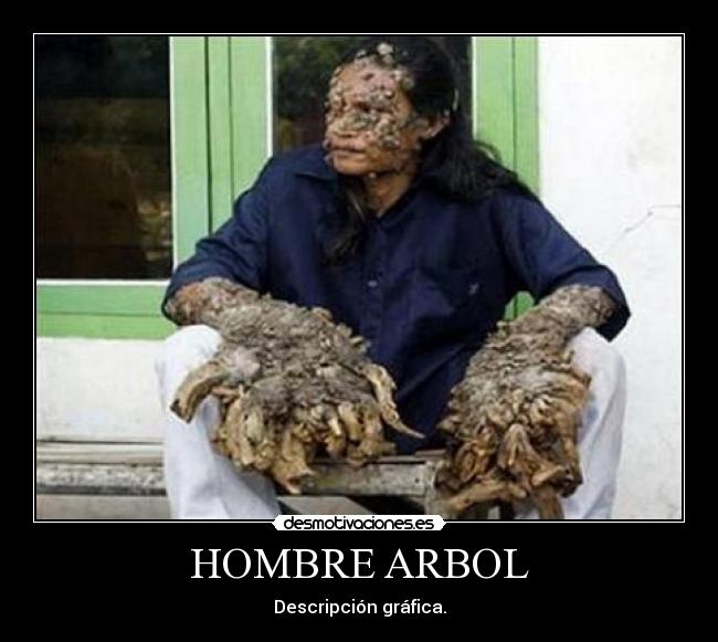 HOMBRE ARBOL - 