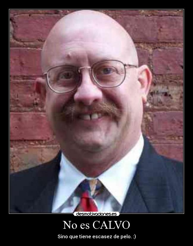 No es CALVO -