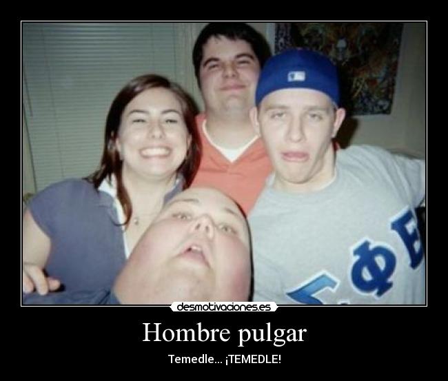 Hombre pulgar -