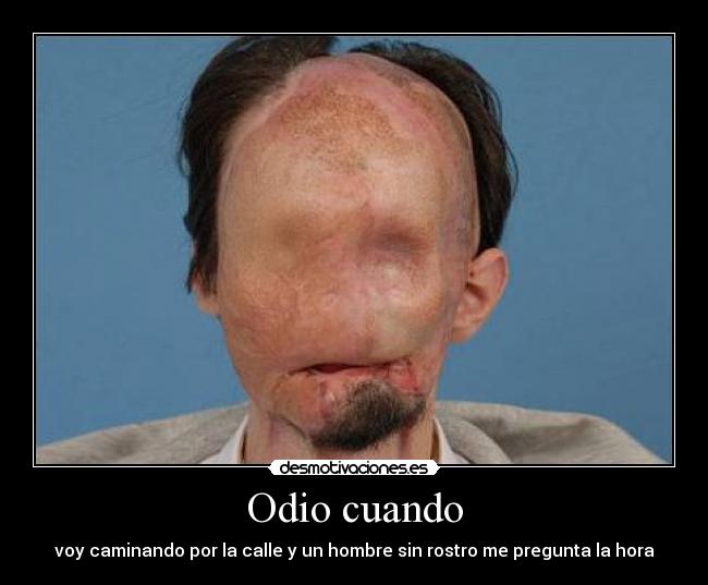 Odio cuando - voy caminando por la calle y un hombre sin rostro me pregunta la hora