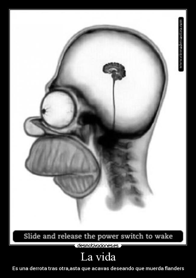 La vida - Es una derrota tras otra,asta que acavas deseando que muerda flanders