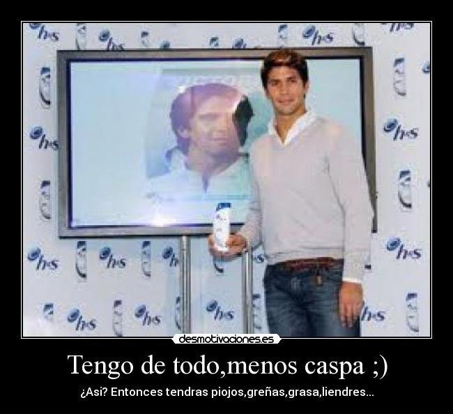 Tengo de todo,menos caspa ;) - 