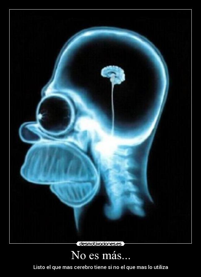 No es más... - Listo el que mas cerebro tiene si no el que mas lo utiliza