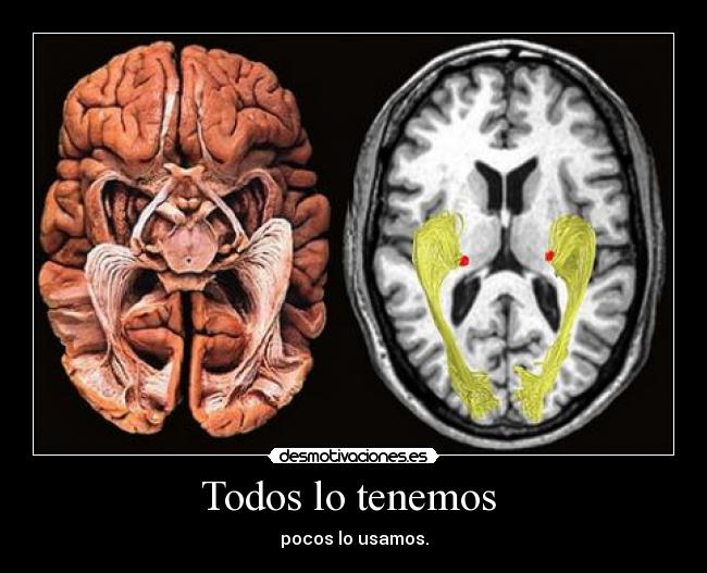 Todos lo tenemos -