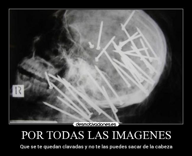 POR TODAS LAS IMAGENES - 