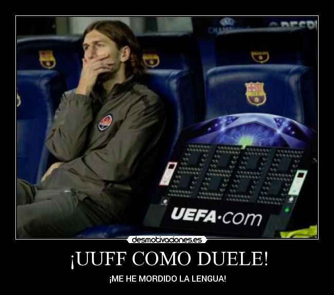 ¡UUFF COMO DUELE! -