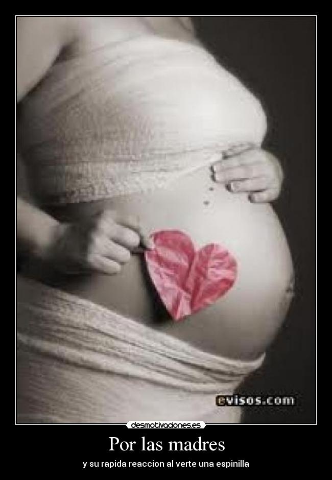 Por las madres - y su rapida reaccion al verte una espinilla