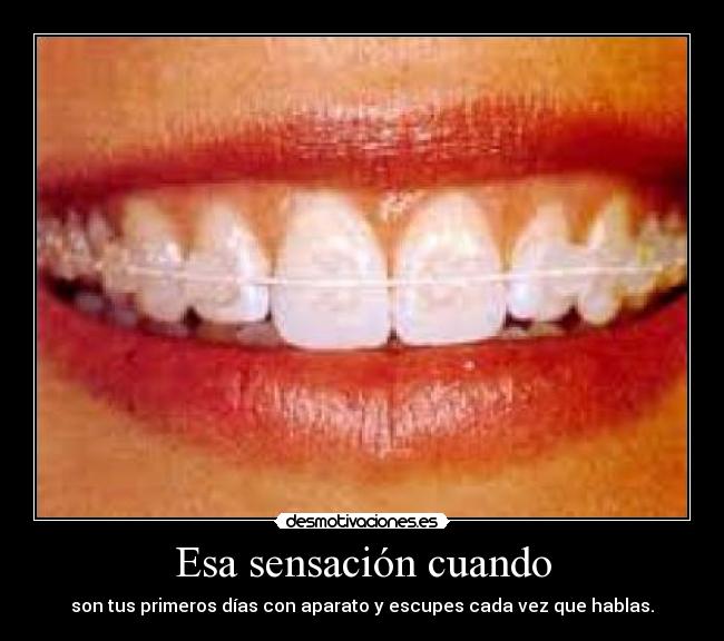 Esa sensación cuando - son tus primeros días con aparato y escupes cada vez que hablas.