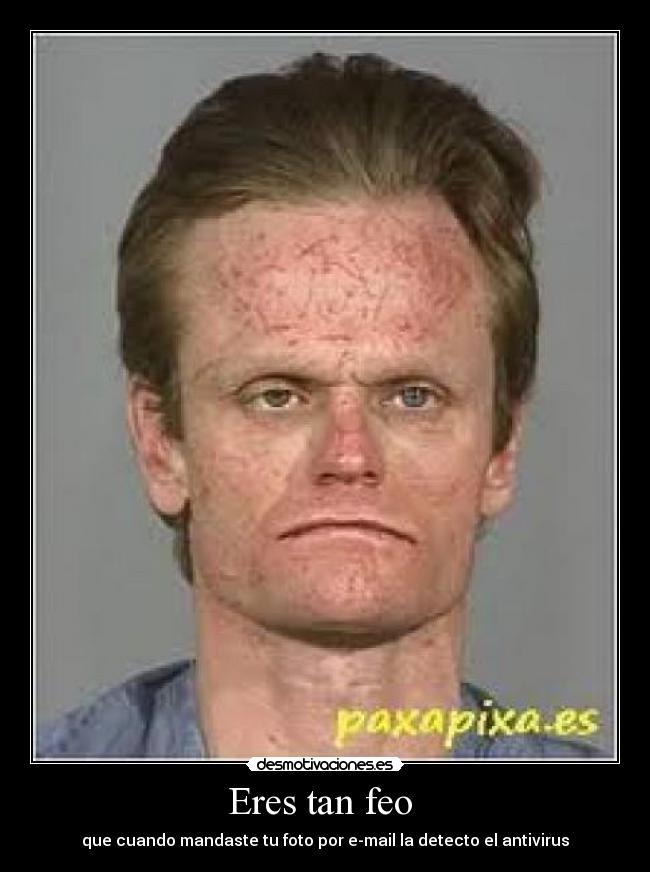 Eres tan feo  - 