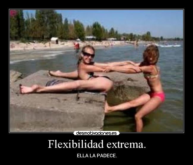 Flexibilidad extrema. - ELLA LA PADECE.