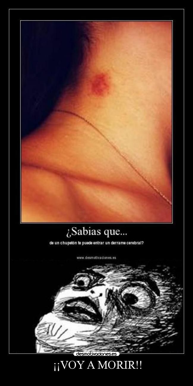 ¡¡VOY A MORIR!! -