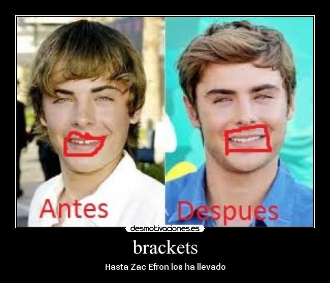 brackets - Hasta Zac Efron los ha llevado