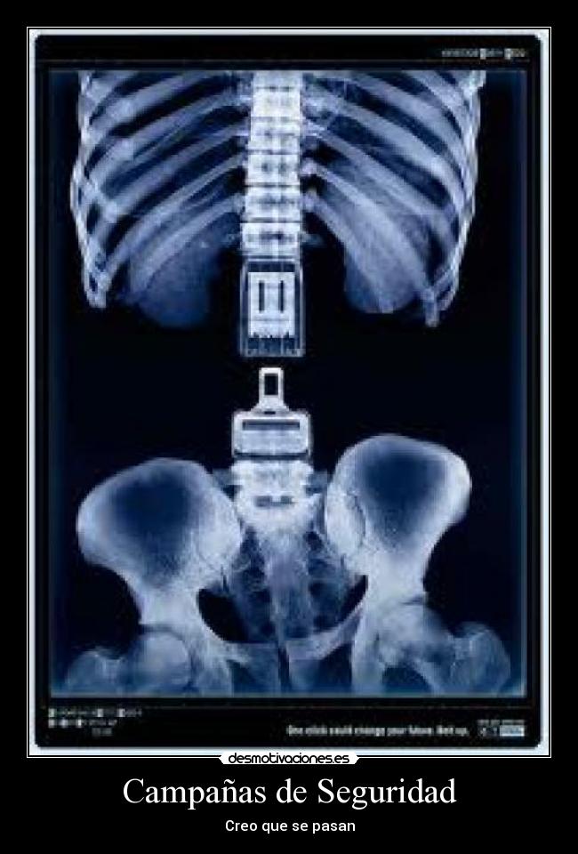 Campañas de Seguridad - Creo que se pasan