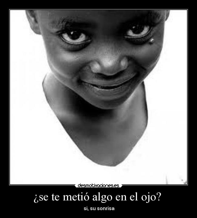 ¿se te metió algo en el ojo? - si, su sonrisa