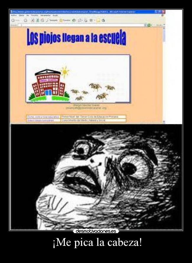¡Me pica la cabeza! -