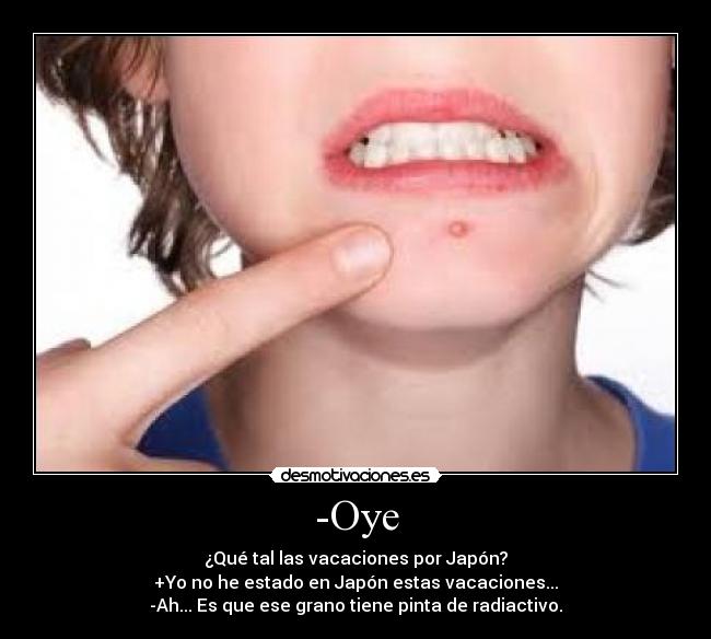 -Oye - ¿Qué tal las vacaciones por Japón?
+Yo no he estado en Japón estas vacaciones...
-Ah... Es que ese grano tiene pinta de radiactivo.