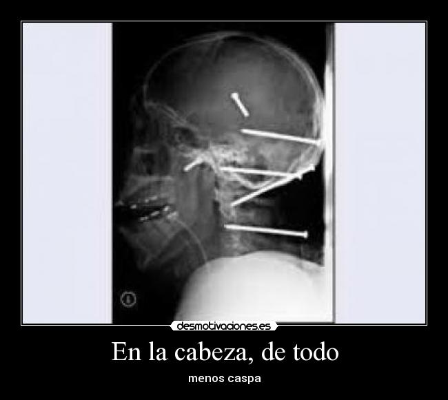 En la cabeza, de todo - 