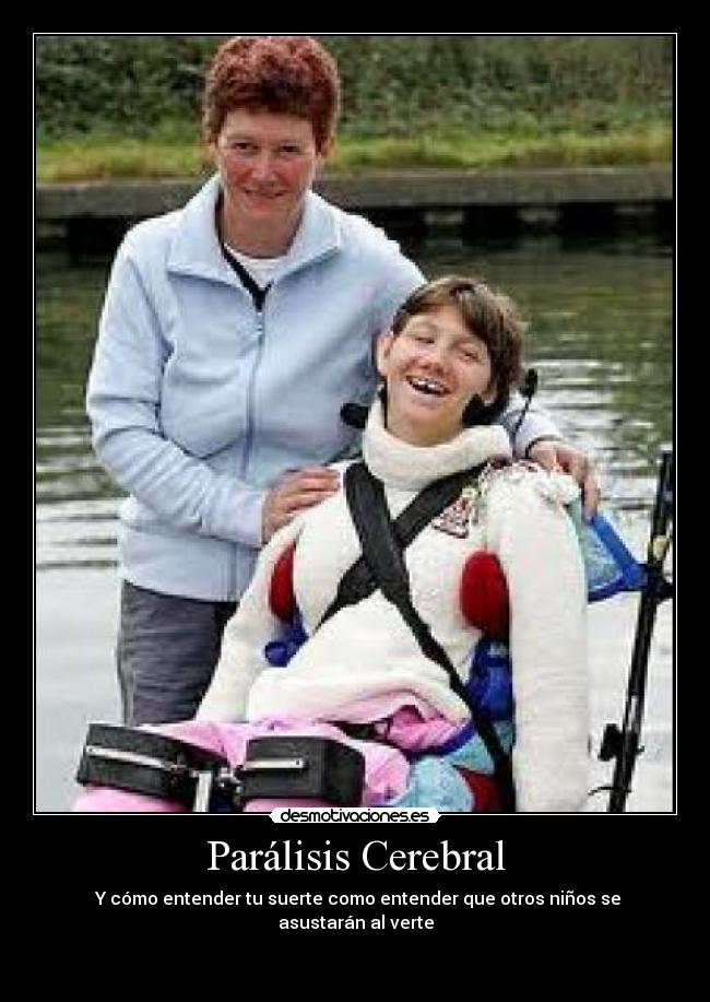 Parálisis Cerebral - Y cómo entender tu suerte como entender que otros niños se asustarán al verte