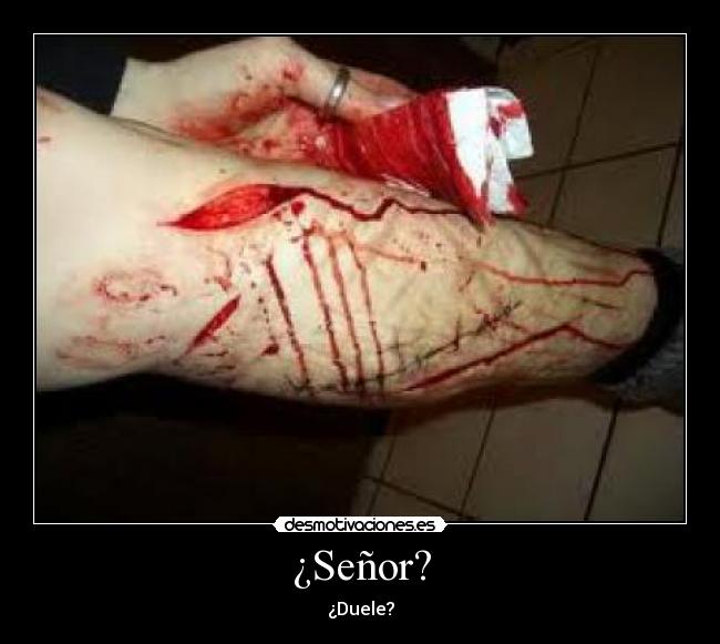 ¿Señor? - ¿Duele?