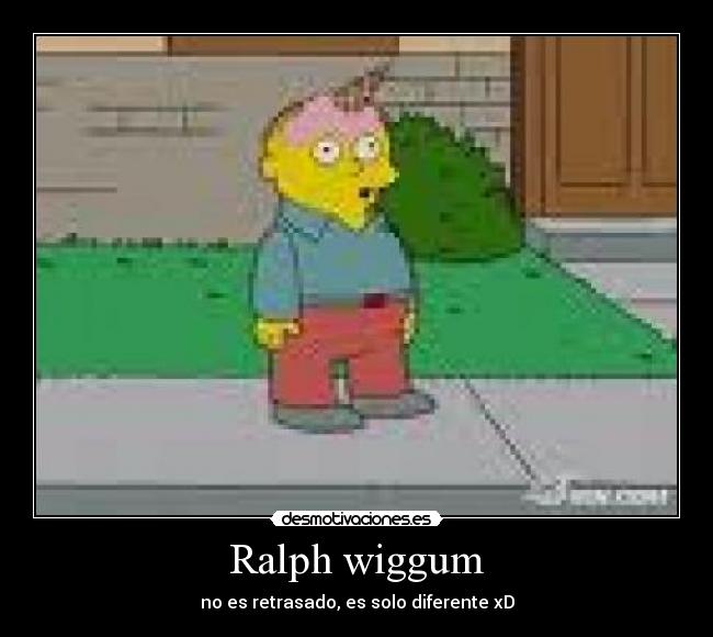 Ralph wiggum - no es retrasado, es solo diferente xD