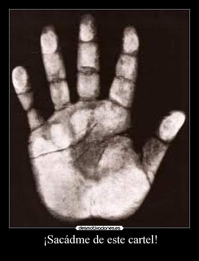 ¡Sacádme de este cartel! -