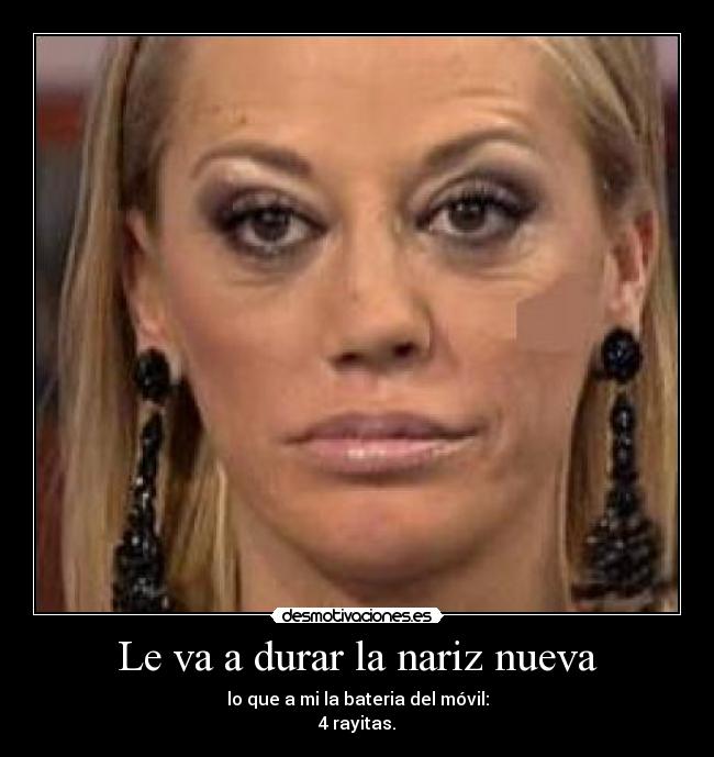 Le va a durar la nariz nueva - lo que a mi la bateria del móvil:
4 rayitas.