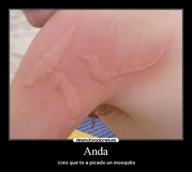 Anda - creo que te a picado un mosquito