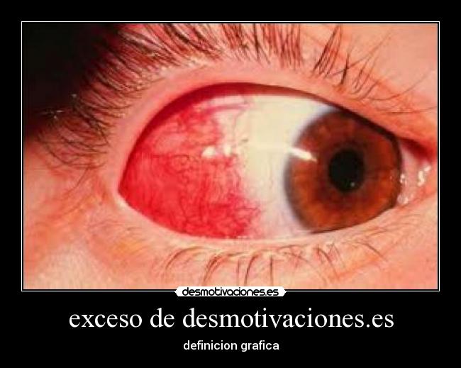 exceso de desmotivaciones.es - 
