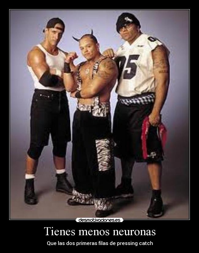 Tienes menos neuronas - 