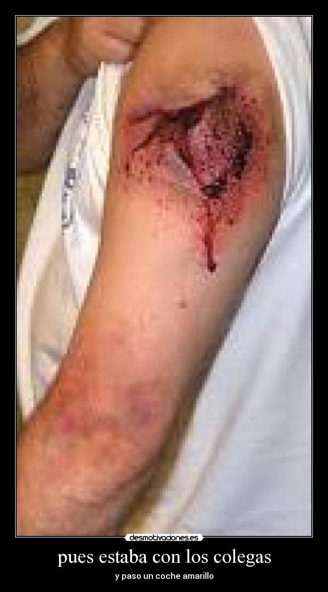 pues estaba con los colegas - y paso un coche amarillo