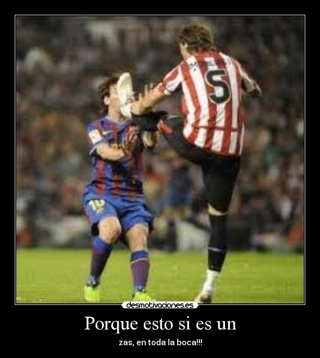 Porque esto si es un -