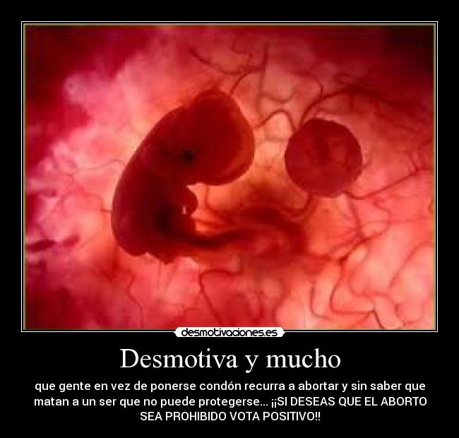 carteles nino con derecho nacer desmotivaciones