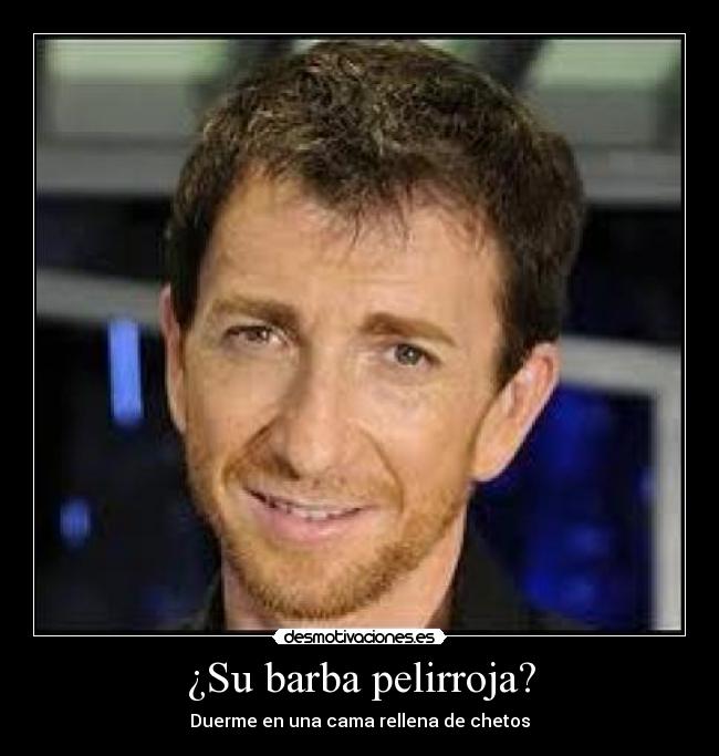 ¿Su barba pelirroja? - Duerme en una cama rellena de chetos