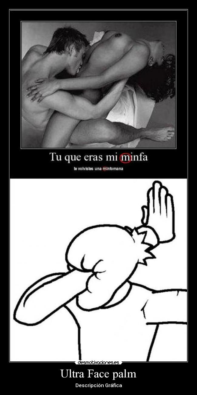 Ultra Face palm - 