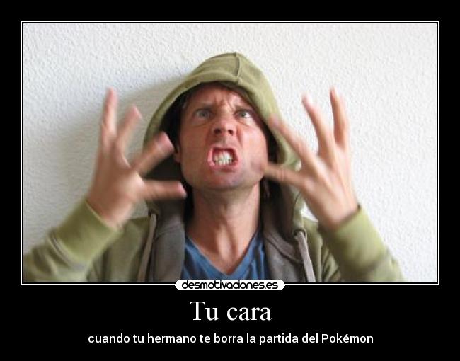 Tu cara - cuando tu hermano te borra la partida del Pokémon