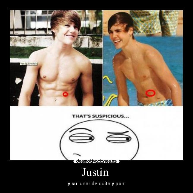 Justin - y su lunar de quita y pón.