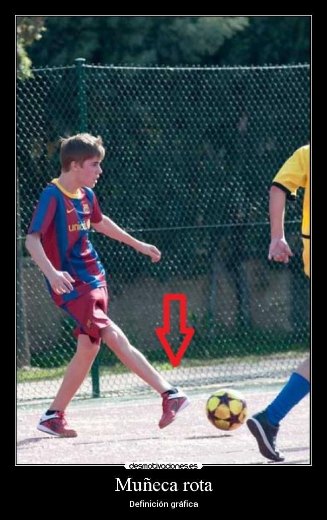 Muñeca rota -