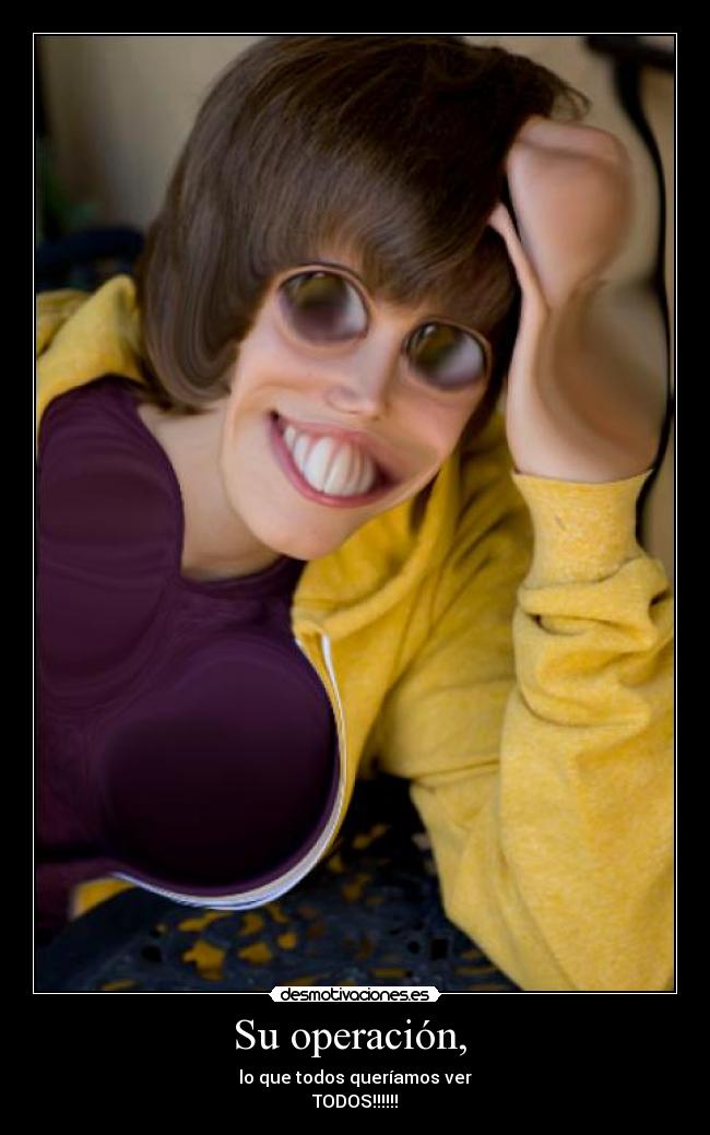 Su operación,  - 