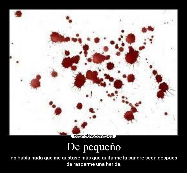 De pequeño - no había nada que me gustase más que quitarme la sangre seca despues
de rascarme una herida.