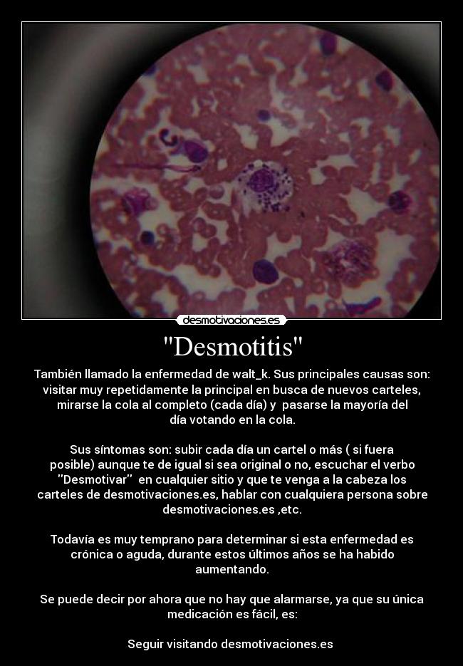 Desmotitis - También llamado la enfermedad de walt_k. Sus principales causas son:
visitar muy repetidamente la principal en busca de nuevos carteles,
mirarse la cola al completo (cada día) y pasarse la mayoría del
día votando en la cola.
Sus síntomas son: subir cada día un cartel o más ( si fuera
posible) aunque te de igual si sea original o no, escuchar el verbo
Desmotivar en cualquier sitio y que te venga a la cabeza los
carteles de desmotivaciones.es, hablar con cualquiera persona sobre
desmotivaciones.es ,etc.
Todavía es muy temprano para determinar si esta enfermedad es
crónica o aguda, durante estos últimos años se ha habido
aumentando.
Se puede decir por ahora que no hay que alarmarse, ya que su única
medicación es fácil, es:
Seguir visitando desmotivaciones.es