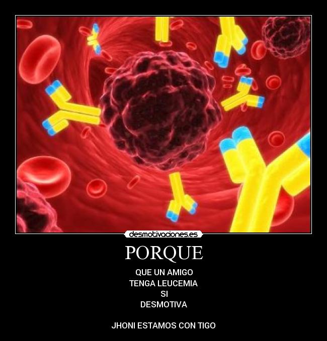 PORQUE - 