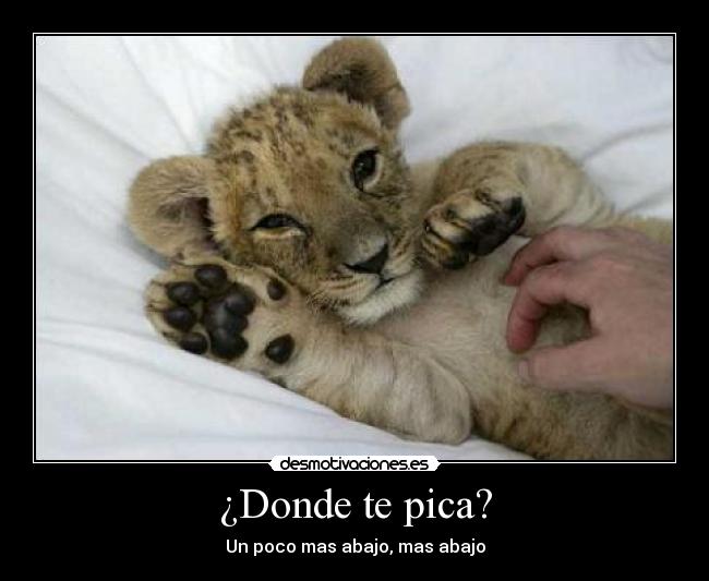 ¿Donde te pica? - 