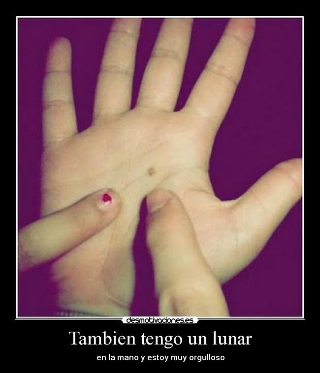 Tambien tengo un lunar -