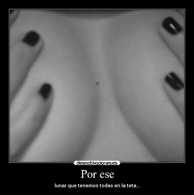 Por ese - 
