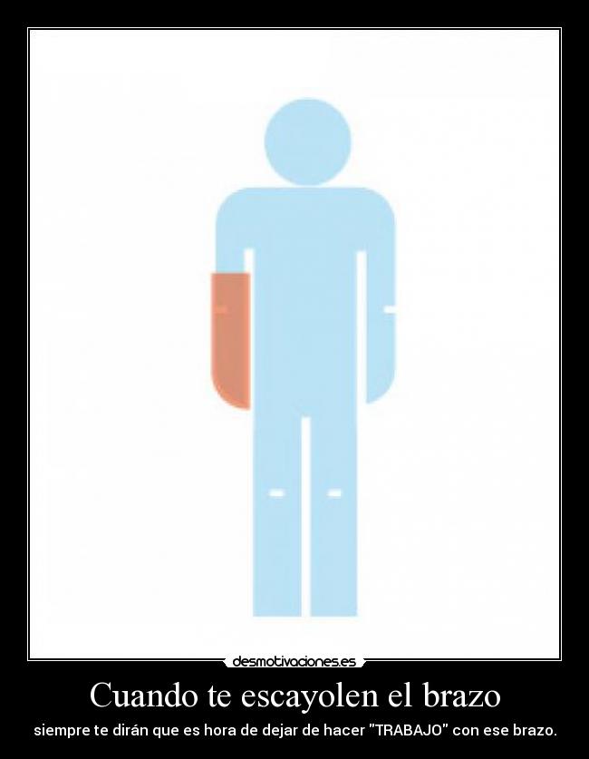 Cuando te escayolen el brazo -
