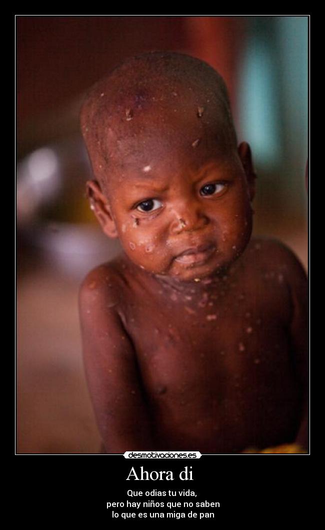 Ahora di  - Que odias tu vida, 
pero hay niños que no saben
lo que es una miga de pan