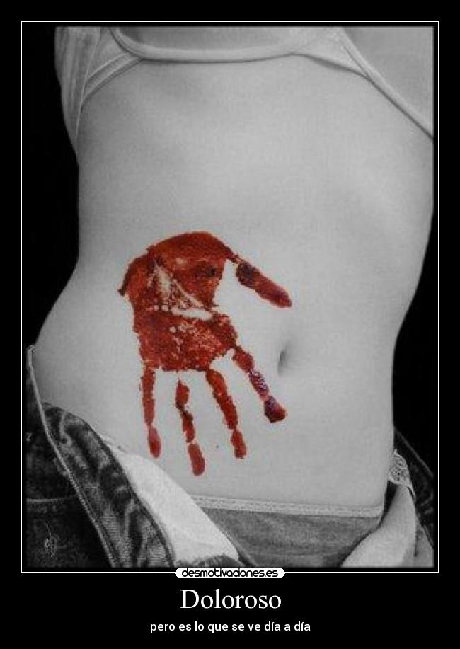 Doloroso - pero es lo que se ve día a día