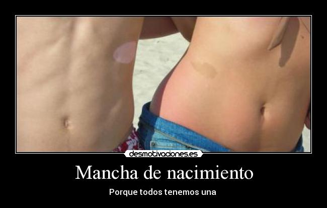 Mancha de nacimiento -