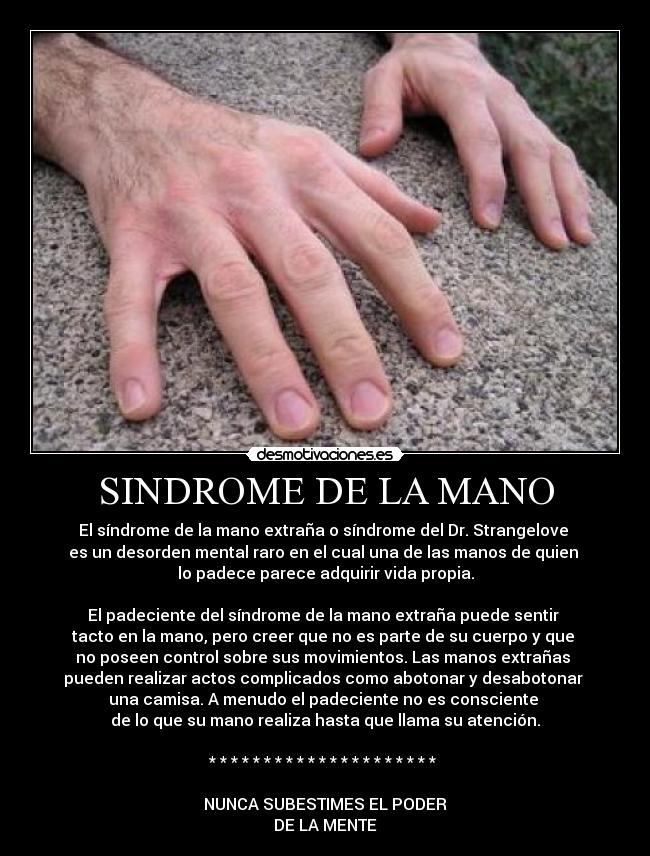 SINDROME DE LA MANO - El síndrome de la mano extraña o síndrome del Dr. Strangelove 
es un desorden mental raro en el cual una de las manos de quien 
lo padece parece adquirir vida propia.

El padeciente del síndrome de la mano extraña puede sentir 
tacto en la mano, pero creer que no es parte de su cuerpo y que 
no poseen control sobre sus movimientos. Las manos extrañas 
pueden realizar actos complicados como abotonar y desabotonar 
una camisa. A menudo el padeciente no es consciente 
de lo que su mano realiza hasta que llama su atención.

* * * * * * * * * * * * * * * * * * * * * 

NUNCA SUBESTIMES EL PODER
DE LA MENTE